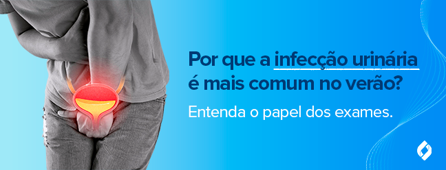 Infecção urinária no verão: identifique cedo com os exames certos.